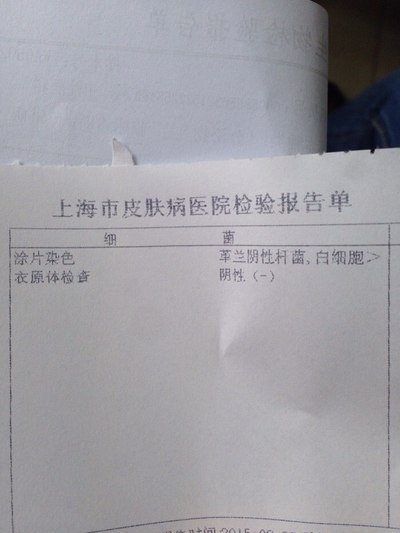 衣原体检查报告出结果了_上海