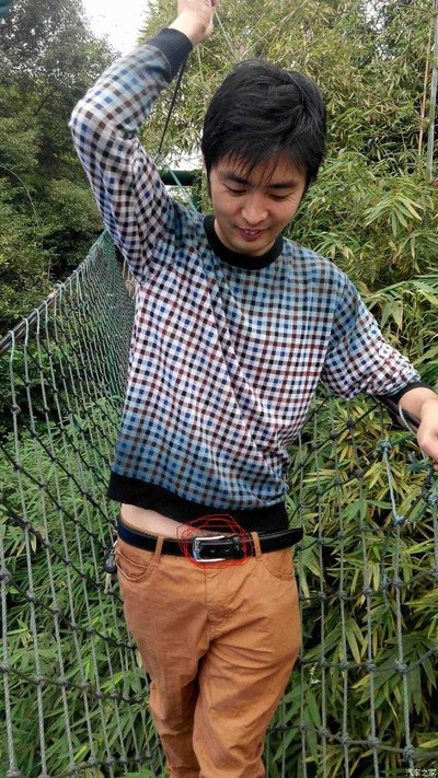 这是谁?毛毛这么多,长到肚子上来了