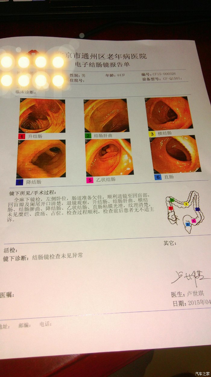 福利北京部分医院免费肠镜检查亲身体验