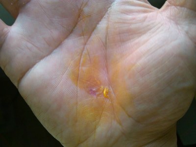 门板包皮了!附作业